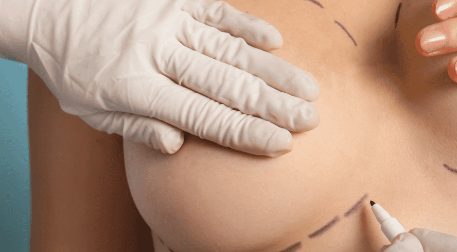 Augmentation mammaire1