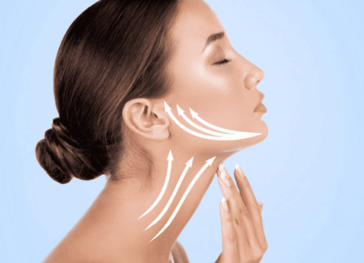 Lifting cervico-facial1