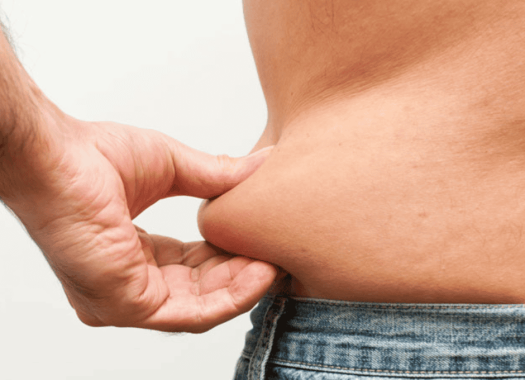 Liposuccion2