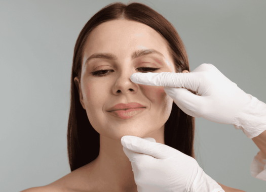 Rhinoplastie2